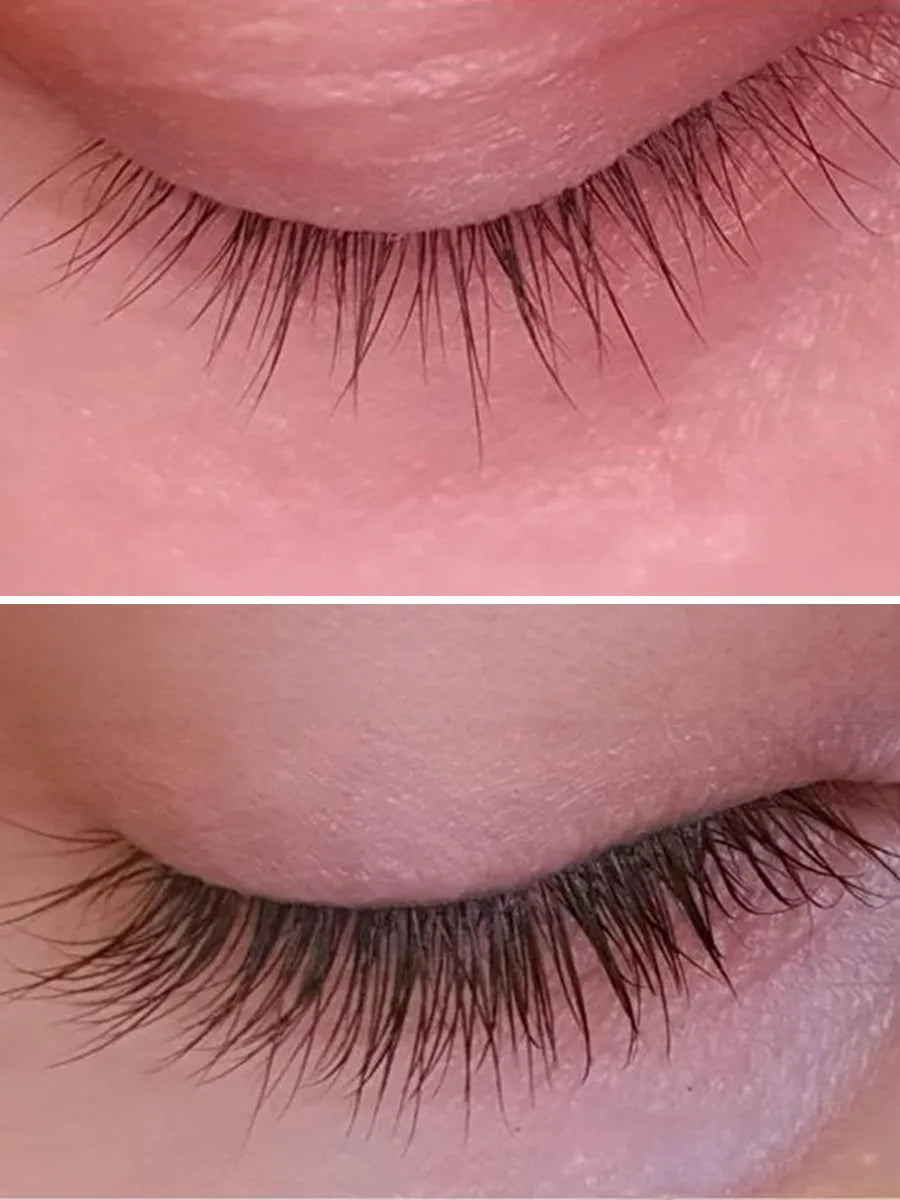 Toplash lash serum before and after results — showing eyelash length and fullness improvement after 8 weeks