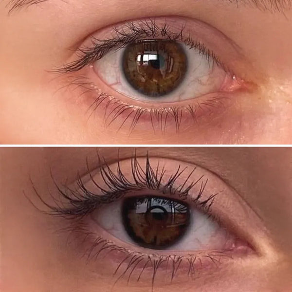 Before and after result